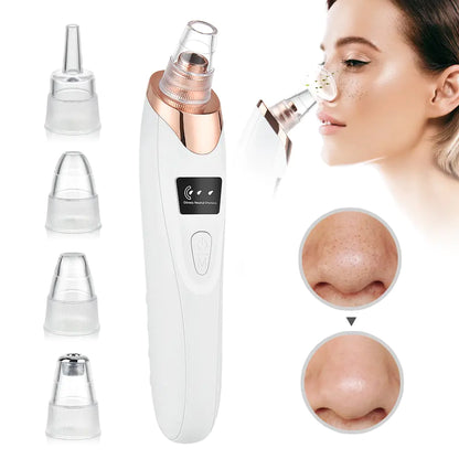 LovelyLuxe™ Blackhead Vacuum